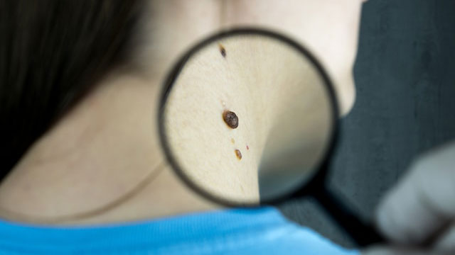 Dermatologia