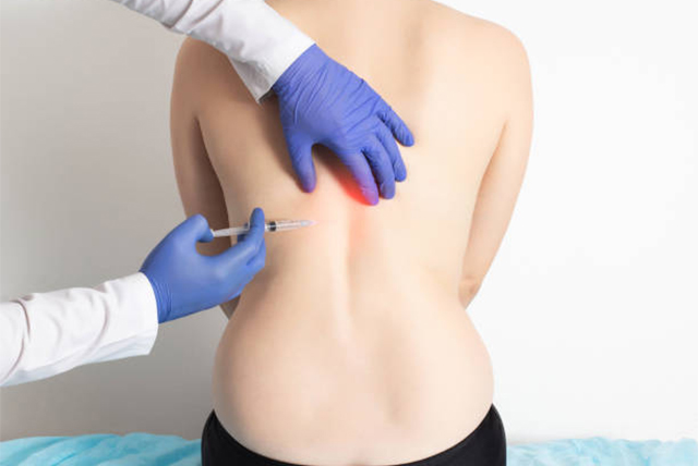Ozonoterapia